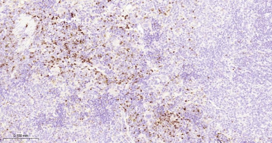 Anti-MMP-9 Antibody (3R987)