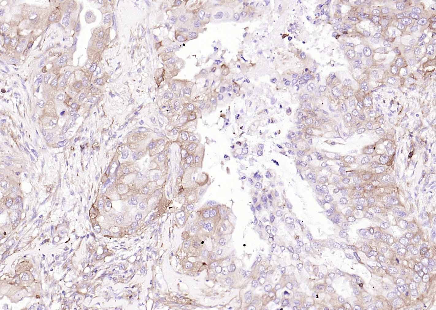 Anti-MRC1 Antibody (6S133)