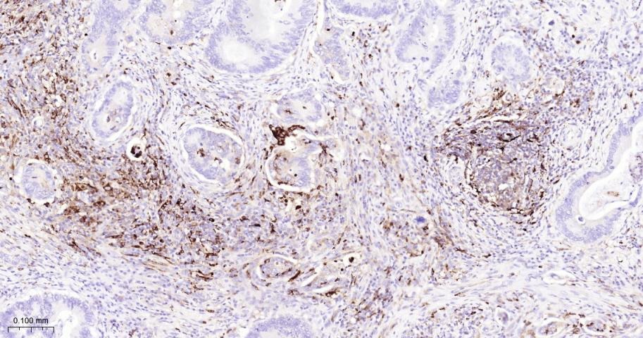 Anti-MMP-9 Antibody (3R987)