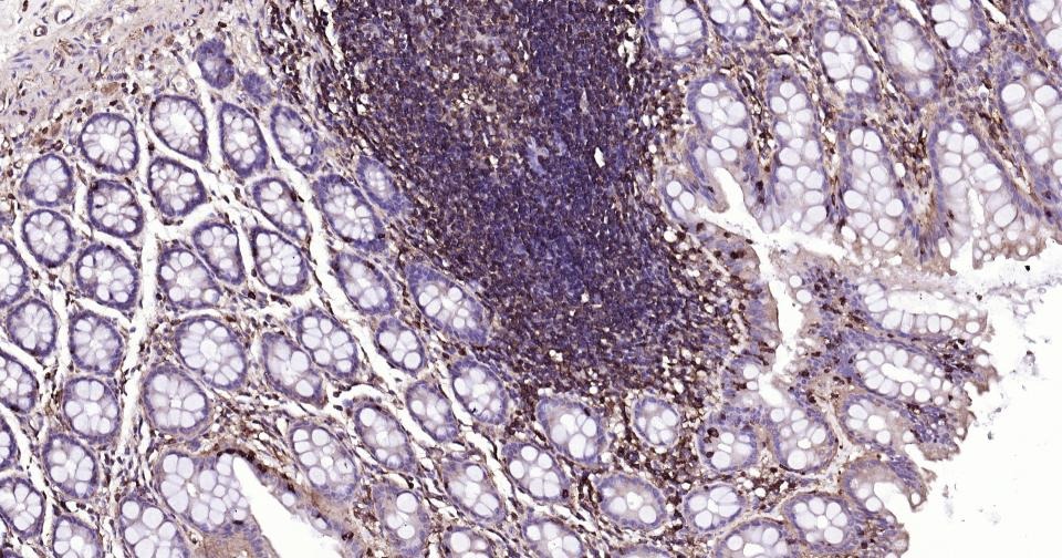 Anti-MRC1 Antibody (6S133)