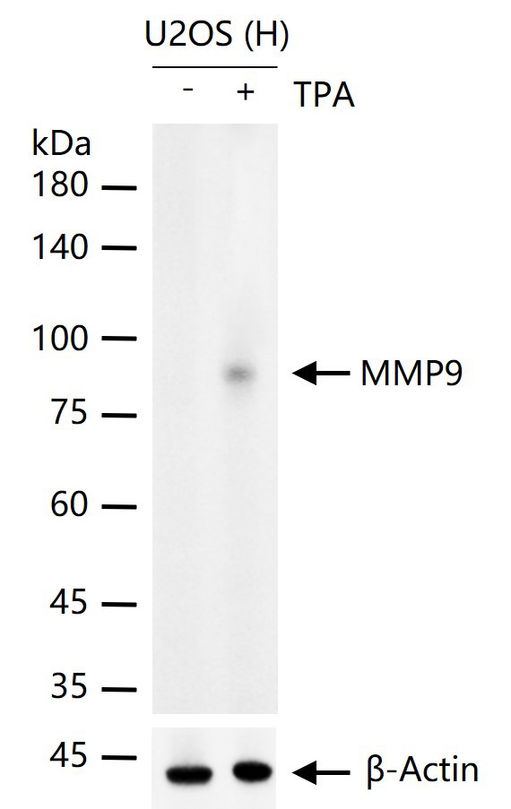 Anti-MMP-9 Antibody (3R987)