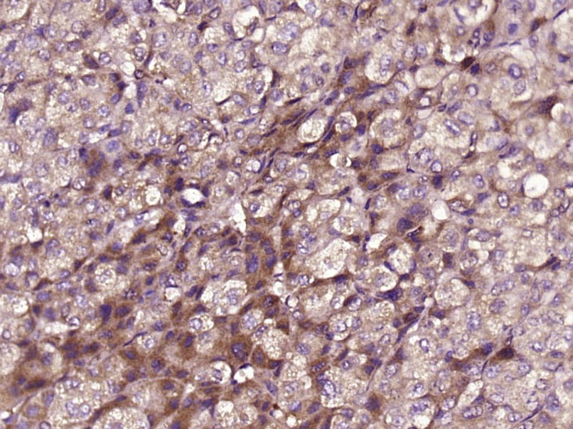 Anti-MPO Polyclonal Antibody 2