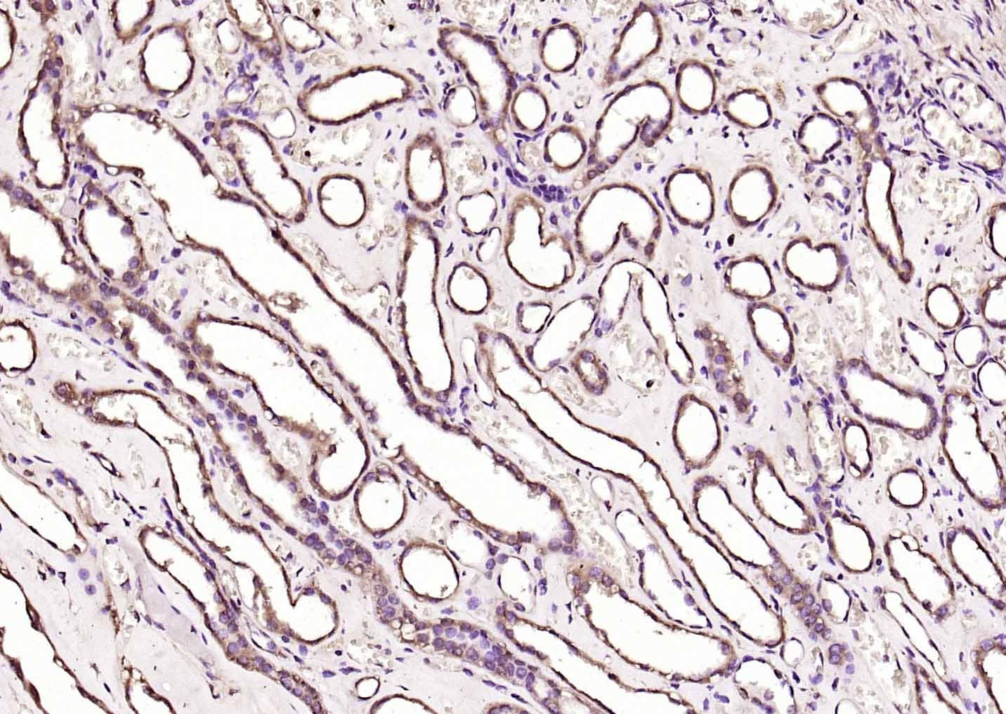 Anti-KRAS Polyclonal Antibody