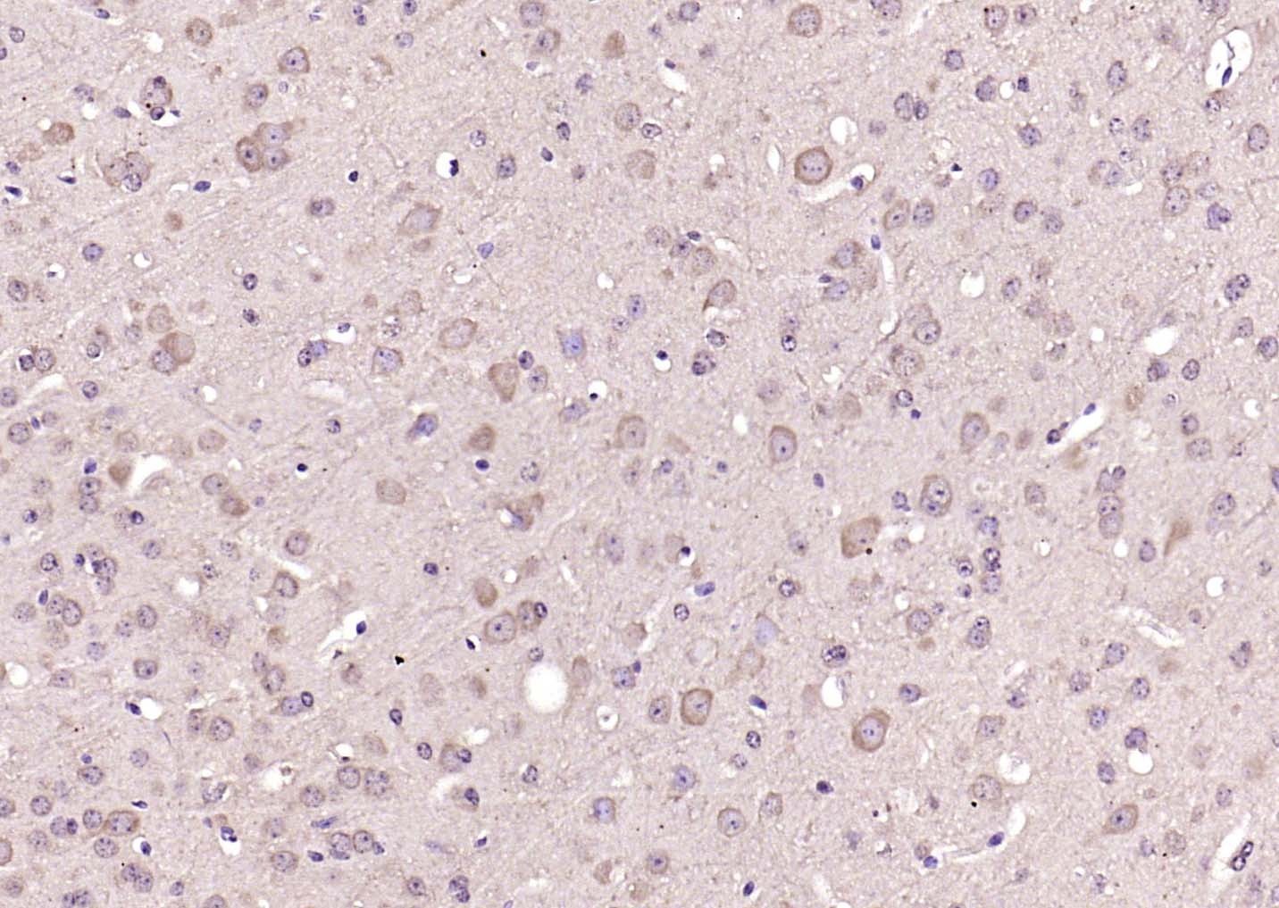 Anti-KRAS Polyclonal Antibody