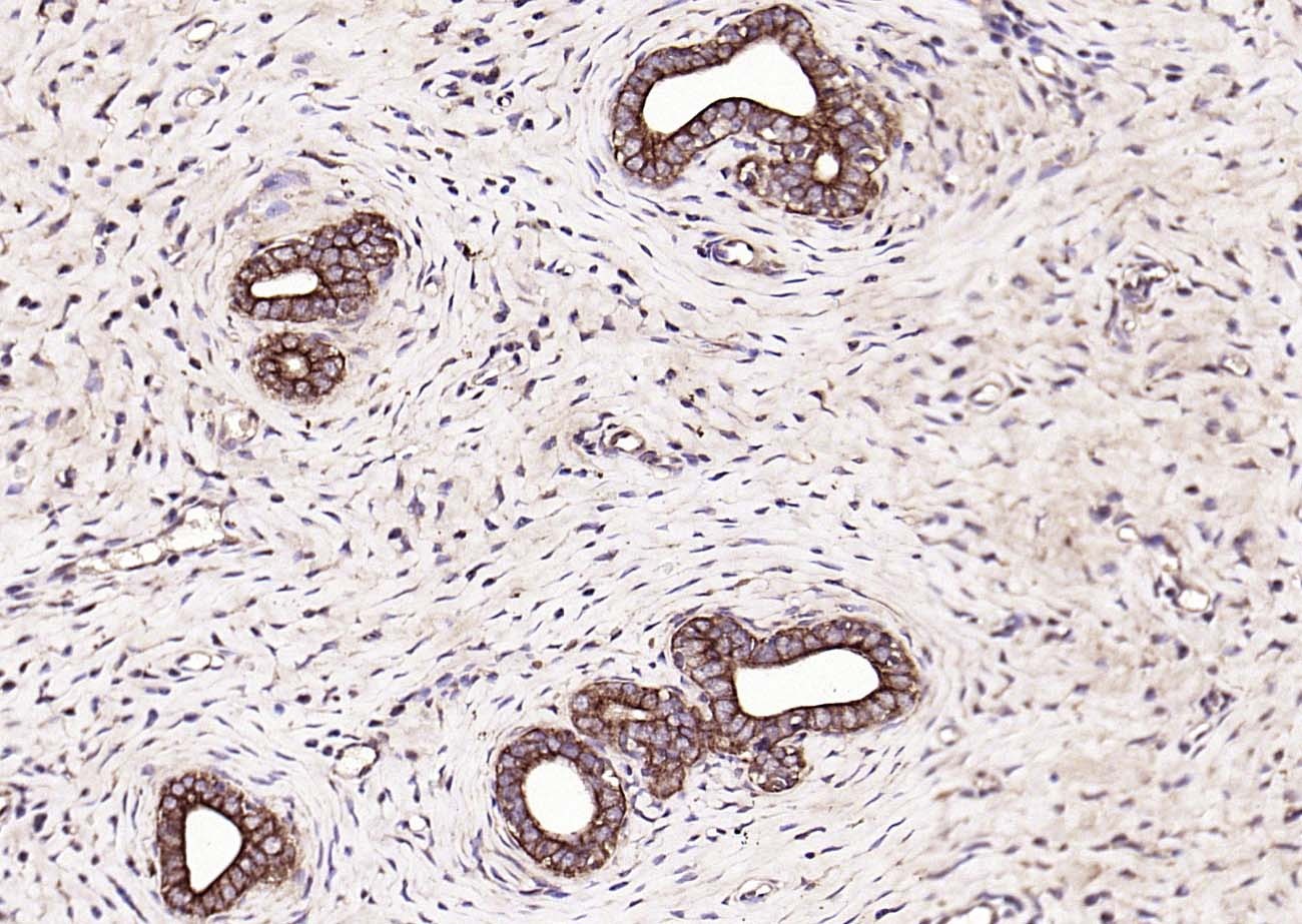 Anti-KRT18 Polyclonal Antibody