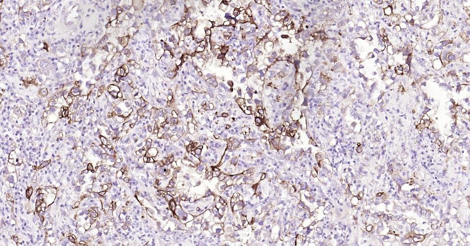 Anti-Integrin alpha 2 Antibody (8P138)