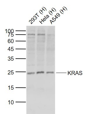Anti-KRAS Polyclonal Antibody