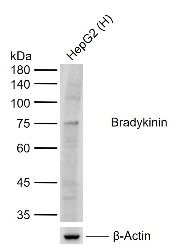 Anti-KNG1 Polyclonal Antibody