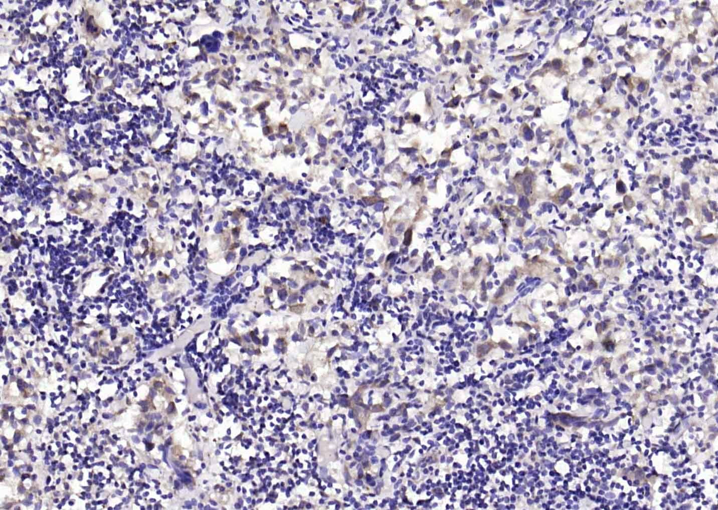 Anti-KRAS Polyclonal Antibody