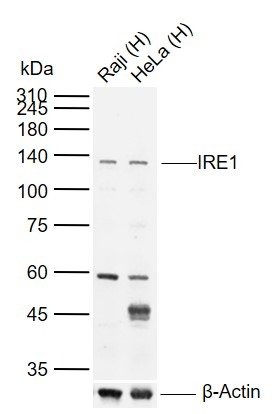 Anti-IRE1 Polyclonal Antibody 2