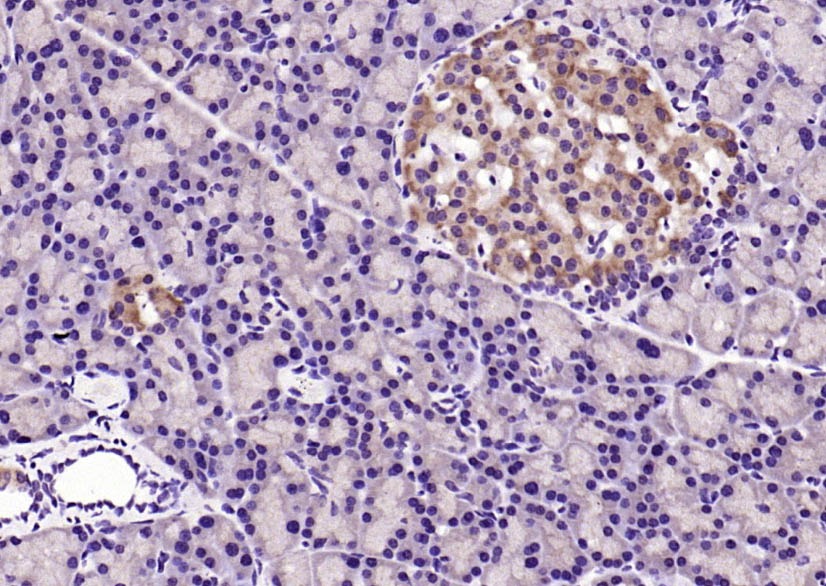 Anti-IRS1 Polyclonal Antibody