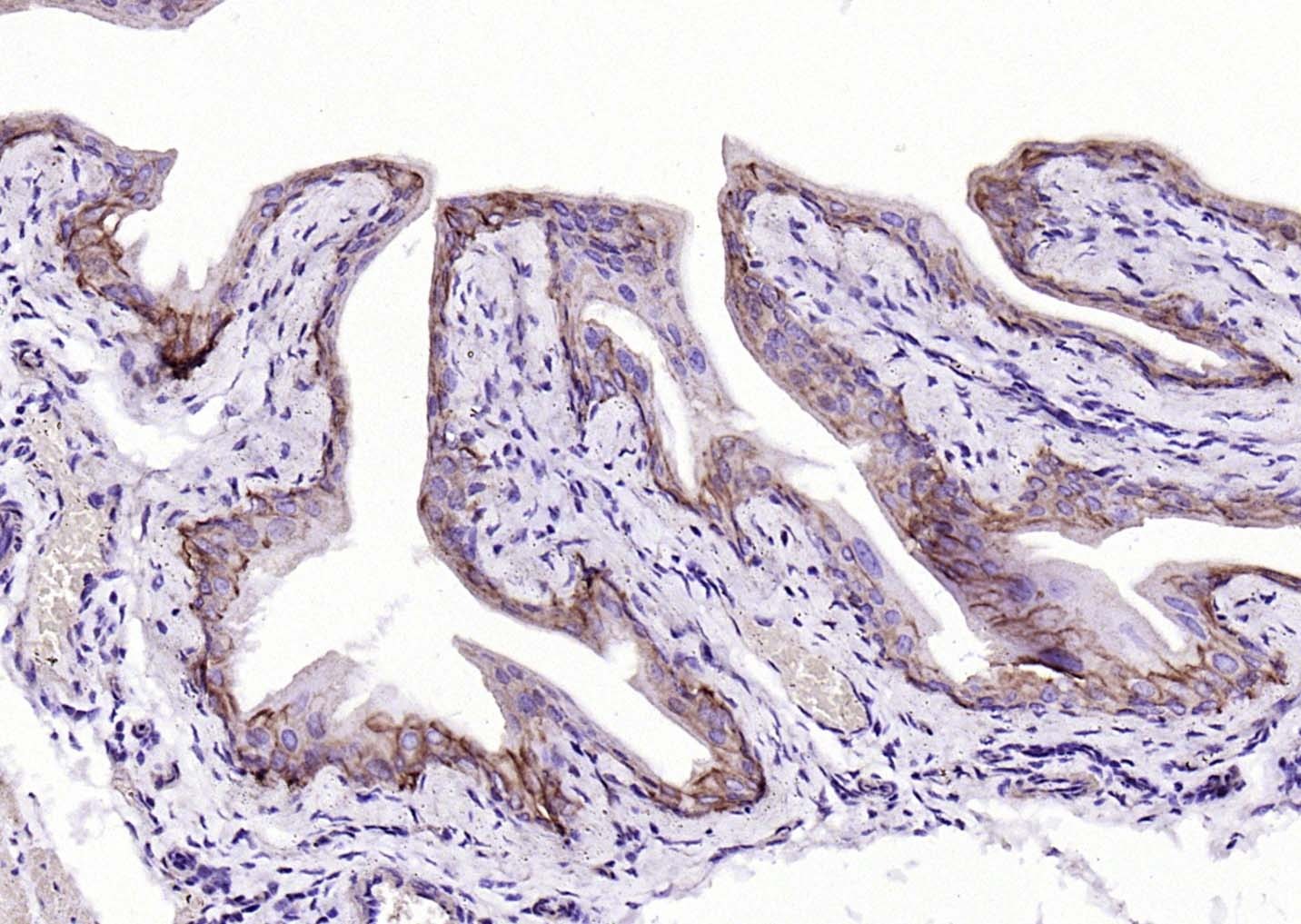 Anti-KRT19 Antibody (2L986)