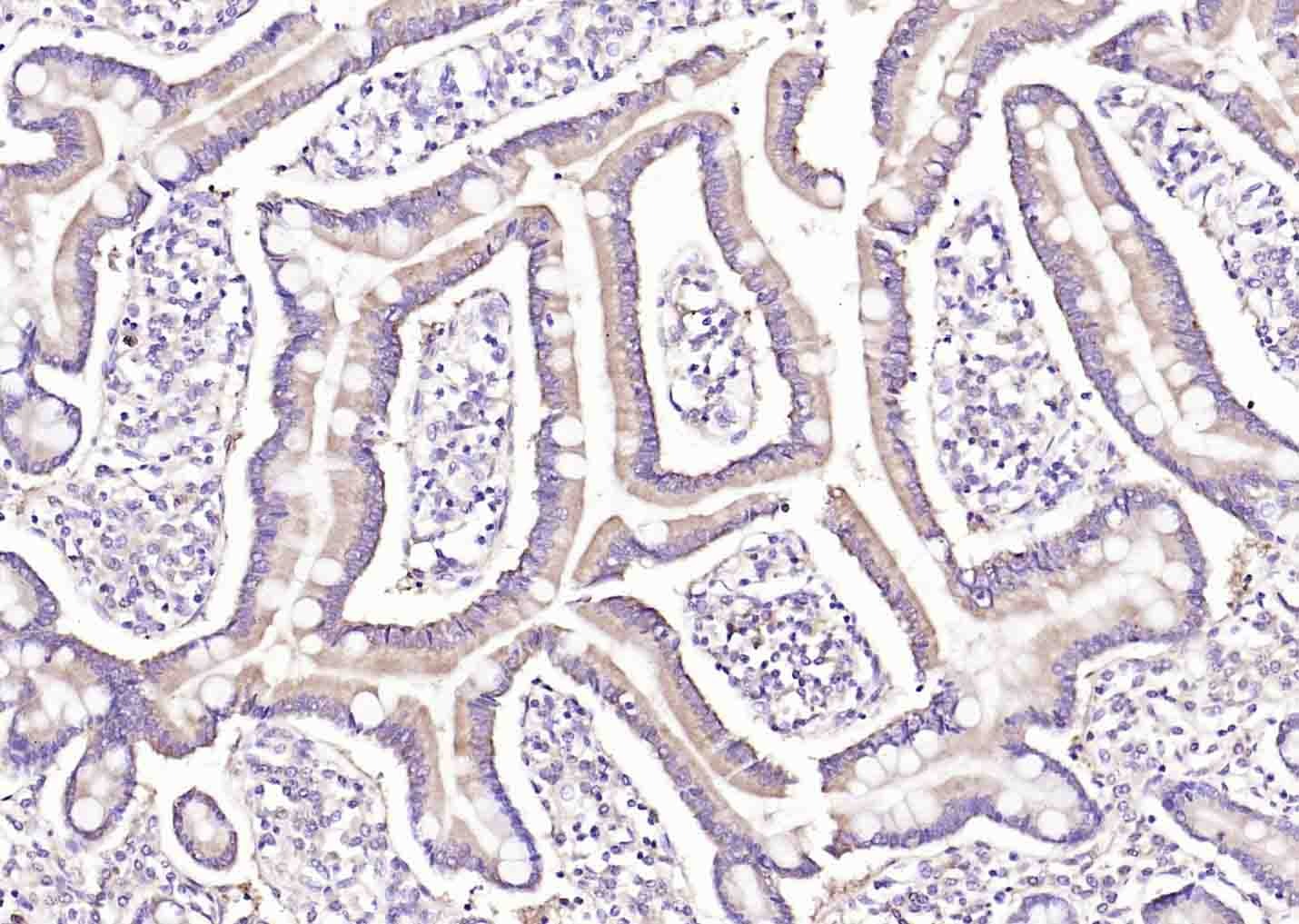Anti-IREB2 Polyclonal Antibody