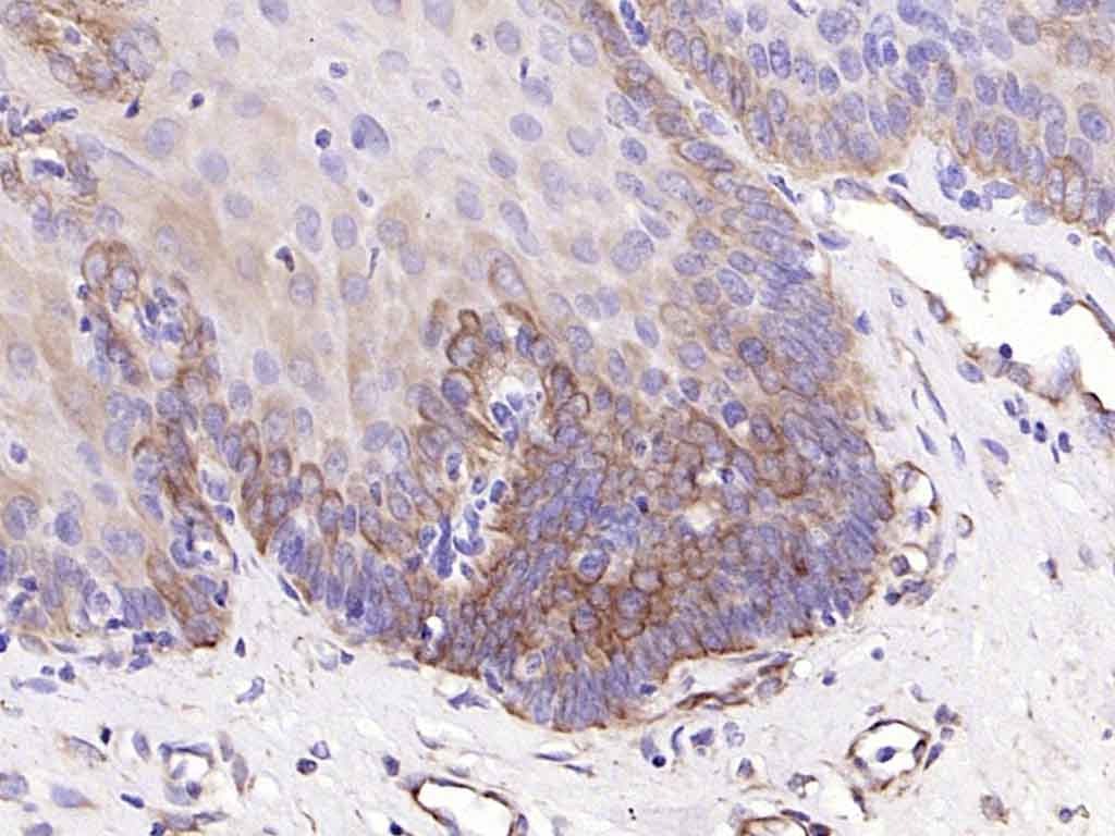 Anti-KRT19 Antibody (2L986)