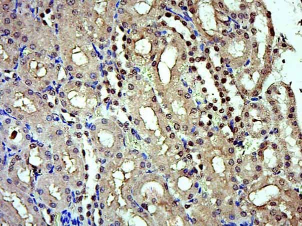 Anti-IRX5 Polyclonal Antibody