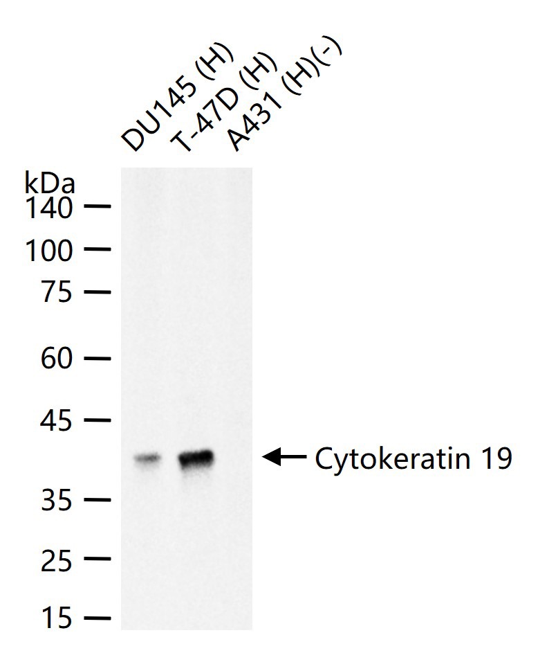 Anti-KRT19 Antibody (2L986)