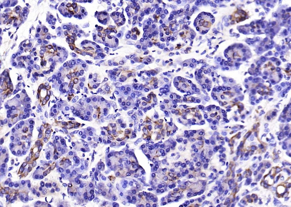 Anti-KRT18 Polyclonal Antibody 2