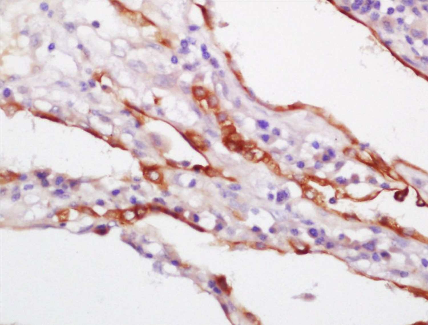 Anti-KRT18 Polyclonal Antibody 2