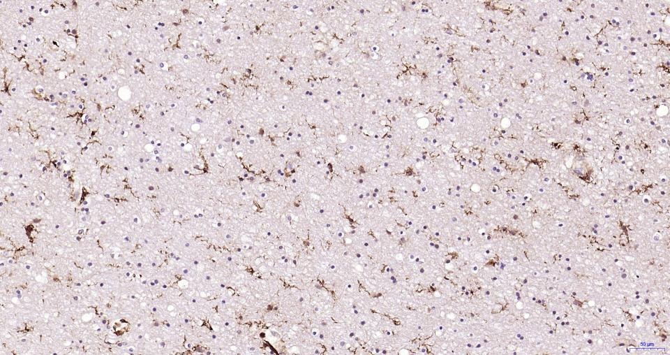 Anti-Iba1 Antibody (1N641)