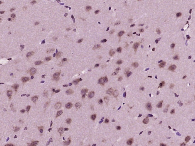 Anti-IRE1 Polyclonal Antibody