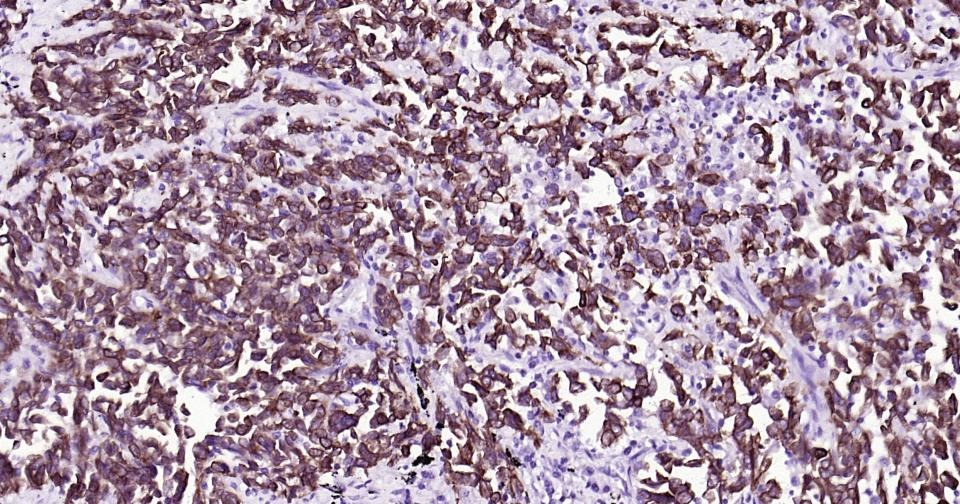Anti-KRT19 Antibody (2L986)