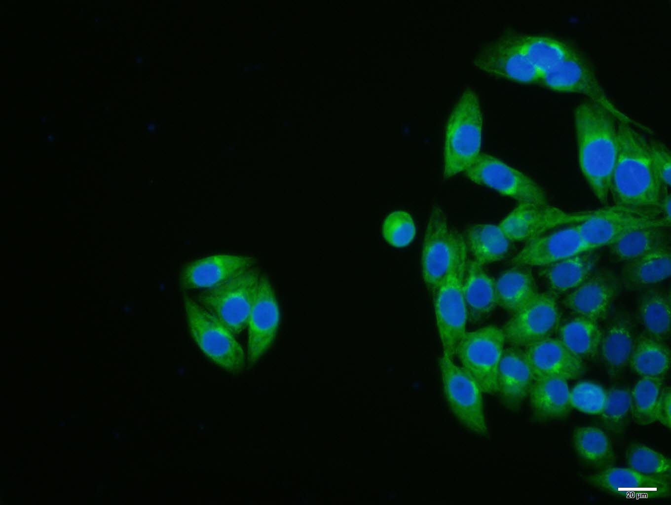 Anti-KRT19 Antibody (2L986)