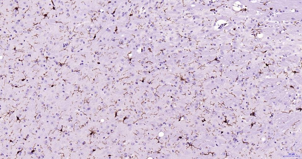 Anti-Iba1 Polyclonal Antibody