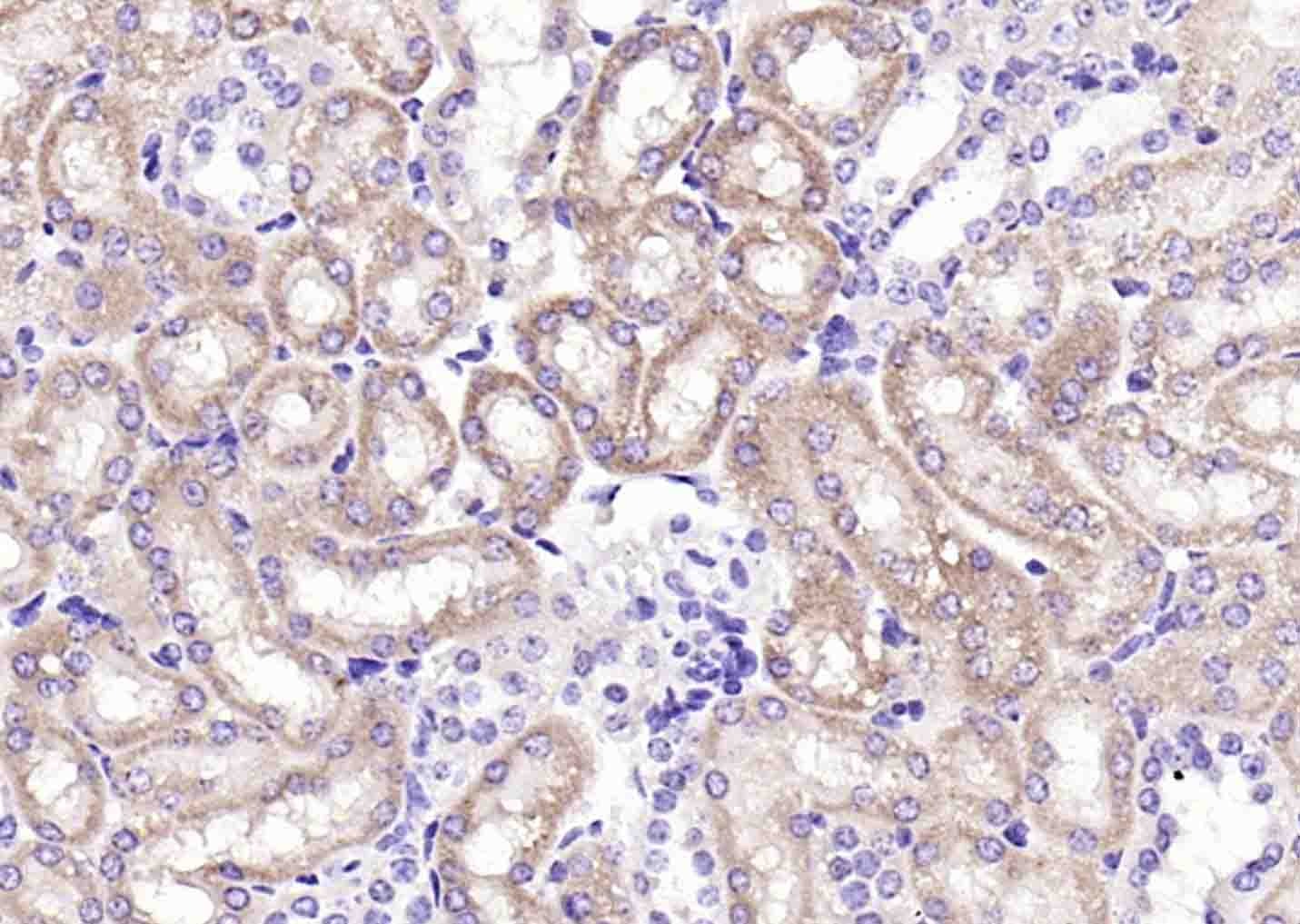 Anti-IREB2 Polyclonal Antibody