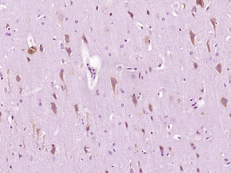 Anti-IRE1 Polyclonal Antibody 2