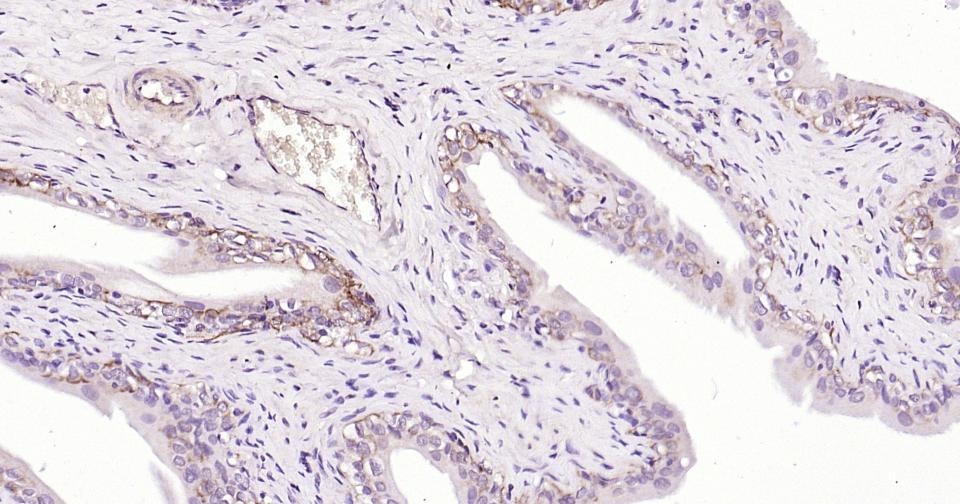 Anti-KRT19 Antibody (2L986)