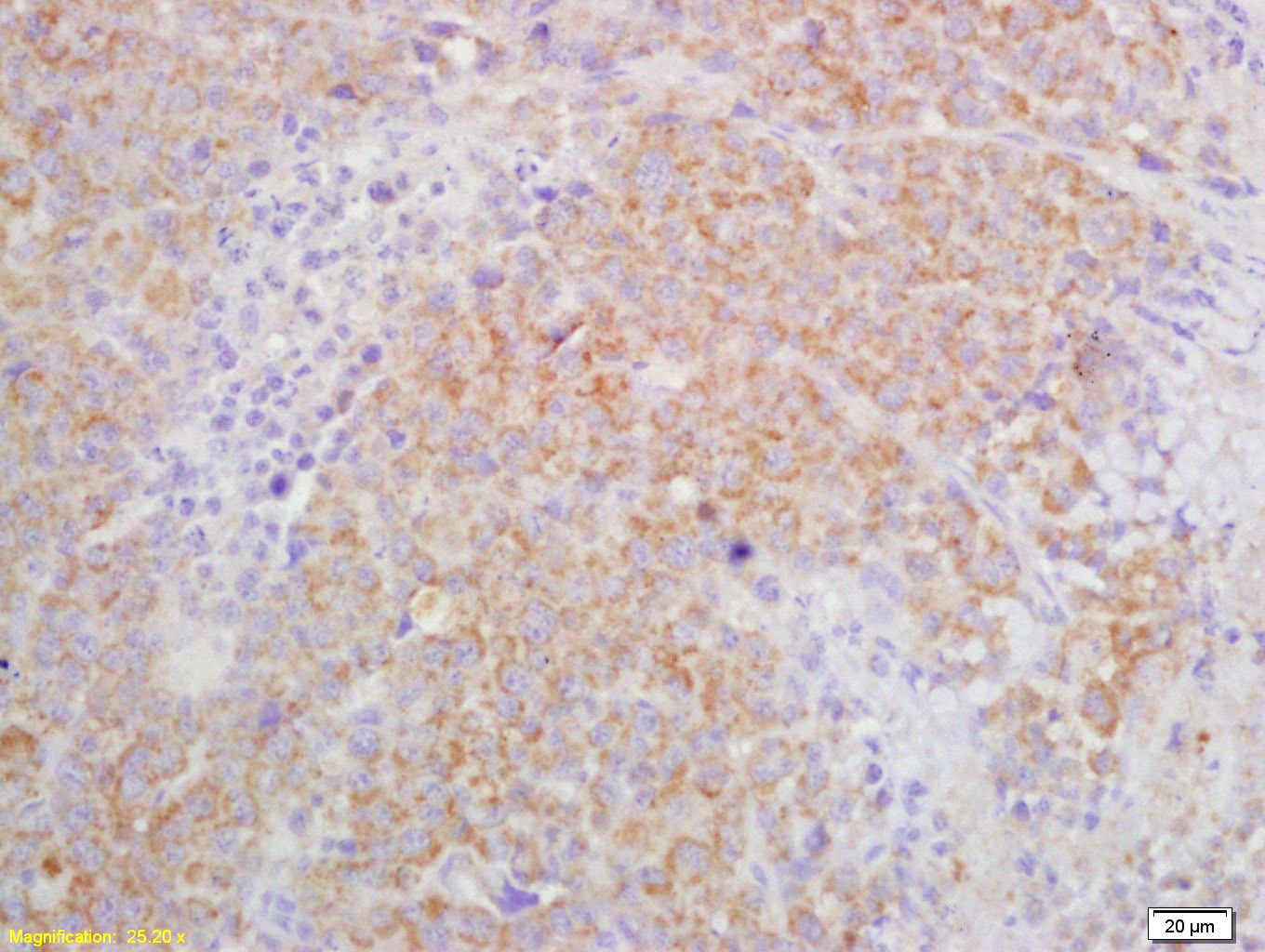 Anti-IL-27RA/TCCR Polyclonal Antibody