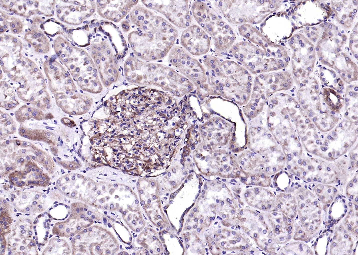 Anti-ITGAV Polyclonal Antibody 2