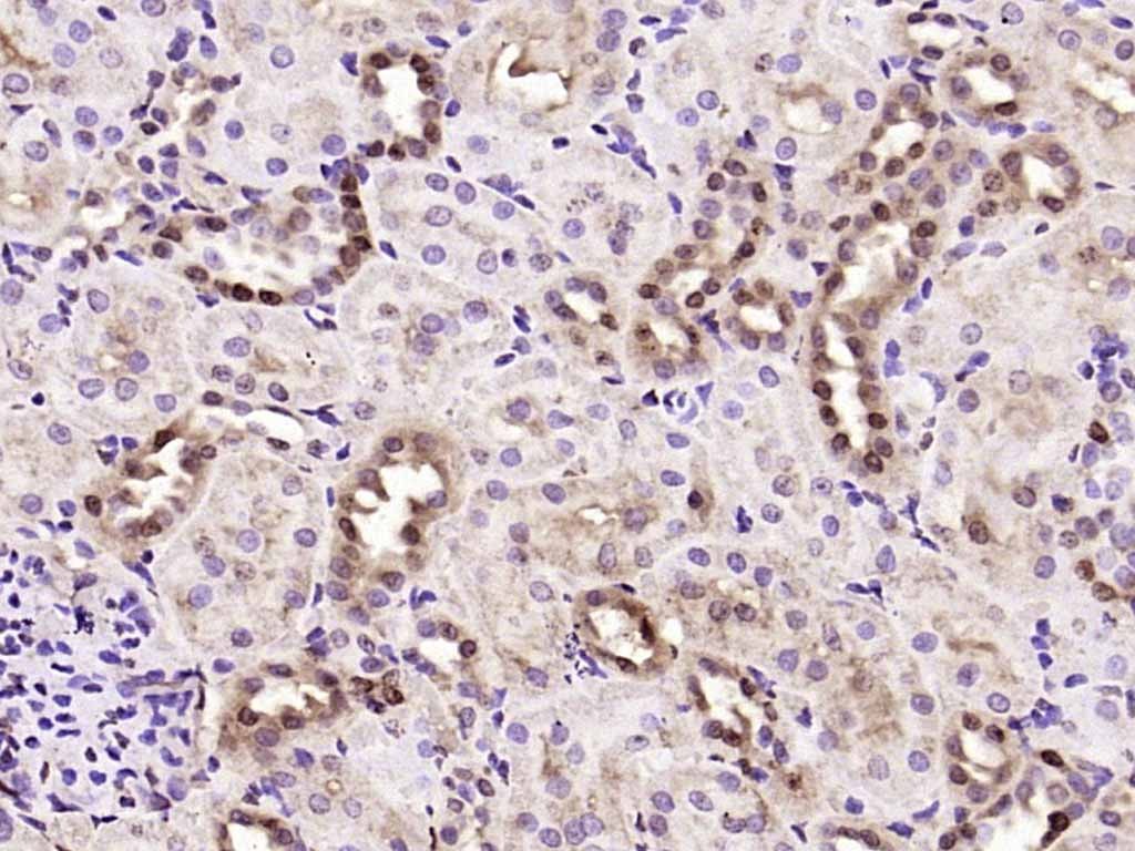 Anti-JNK1/2/3 Polyclonal Antibody