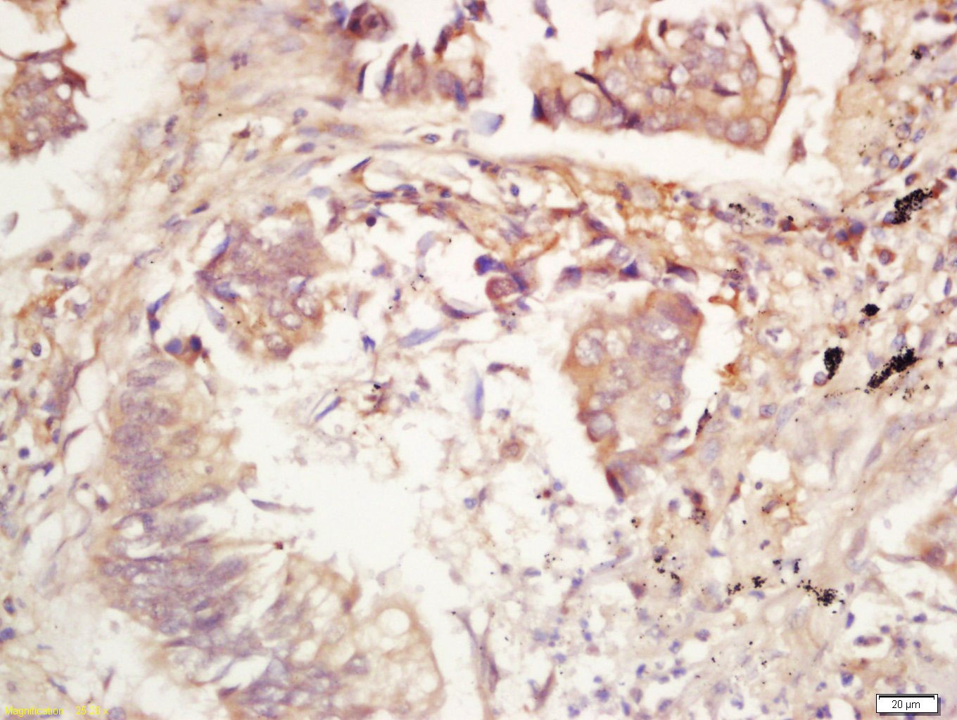 Anti-IL-25/IL-17E Polyclonal Antibody
