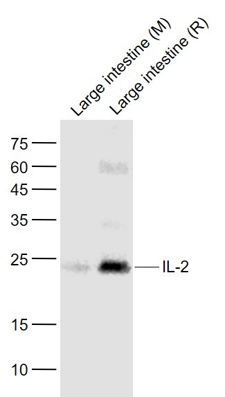Anti-IL-2 Polyclonal Antibody
