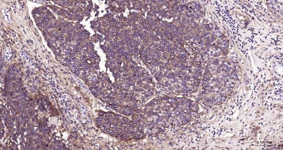 Anti-ITGAV Polyclonal Antibody