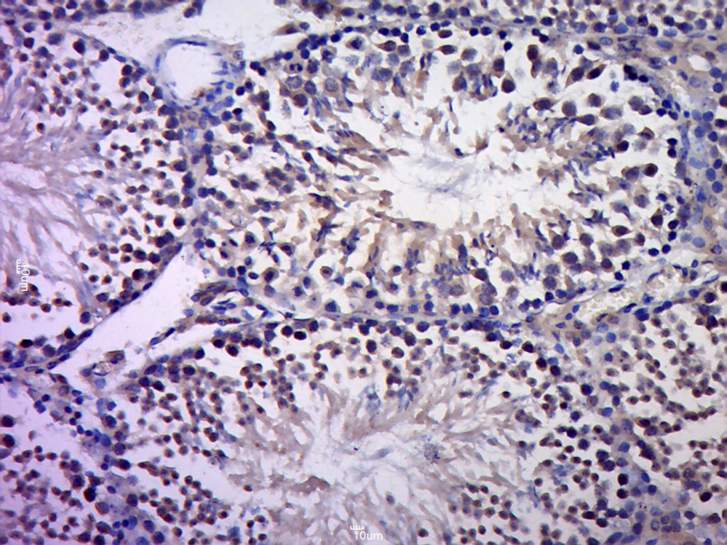 Anti-JUN Polyclonal Antibody