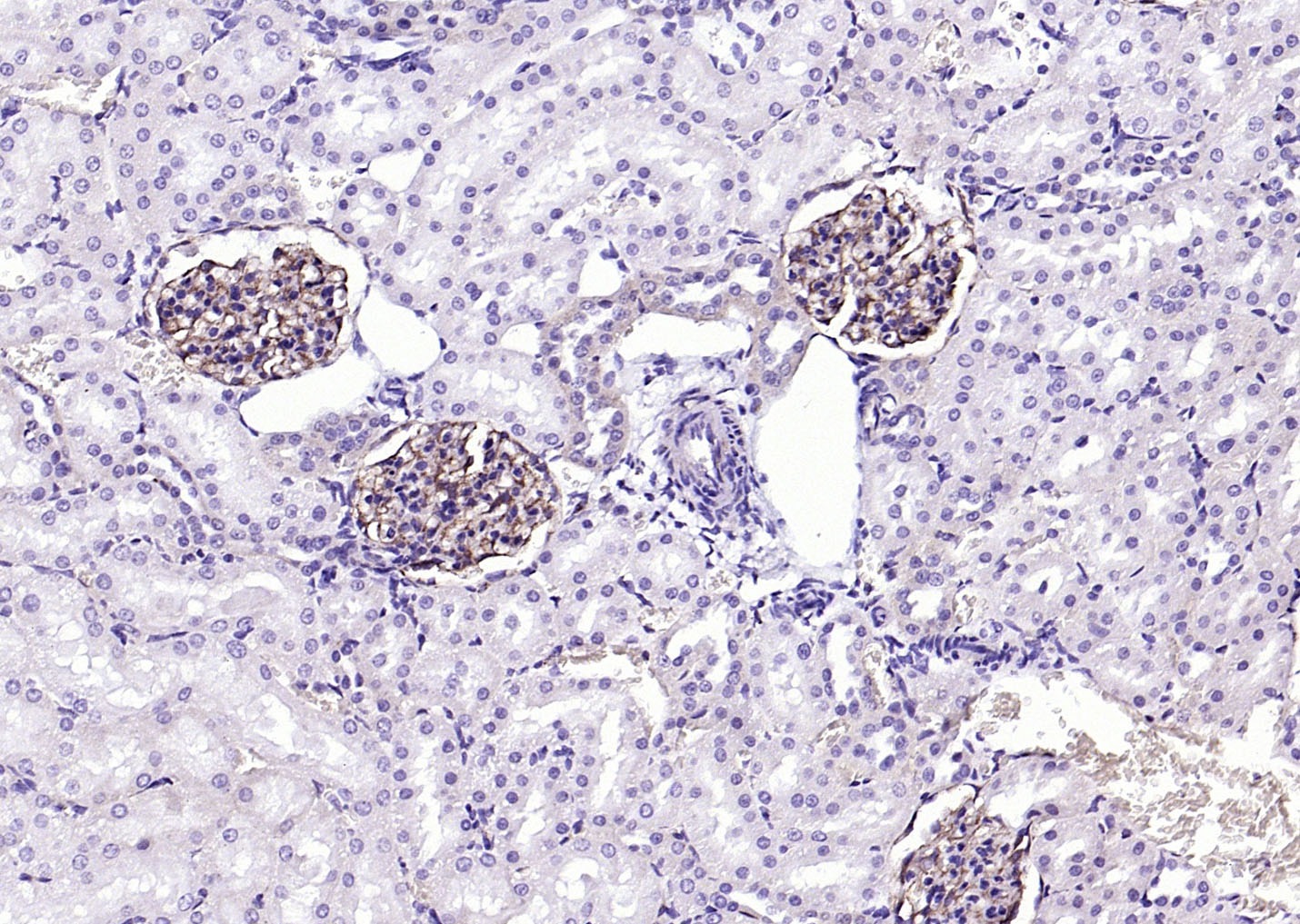 Anti-ITGAV Polyclonal Antibody 2
