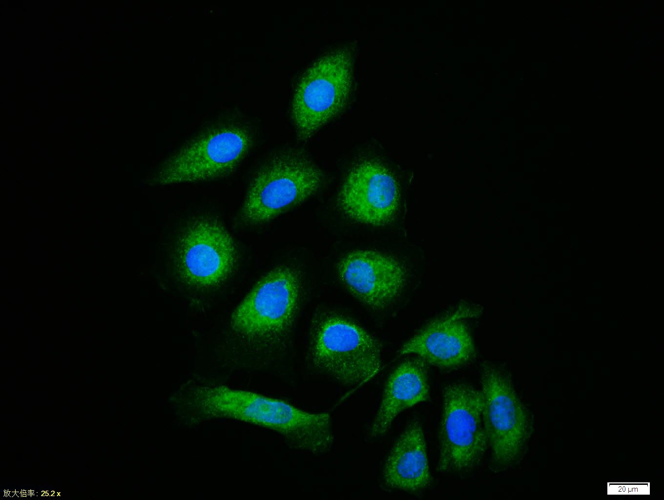 Anti-IL-1R1 Polyclonal Antibody