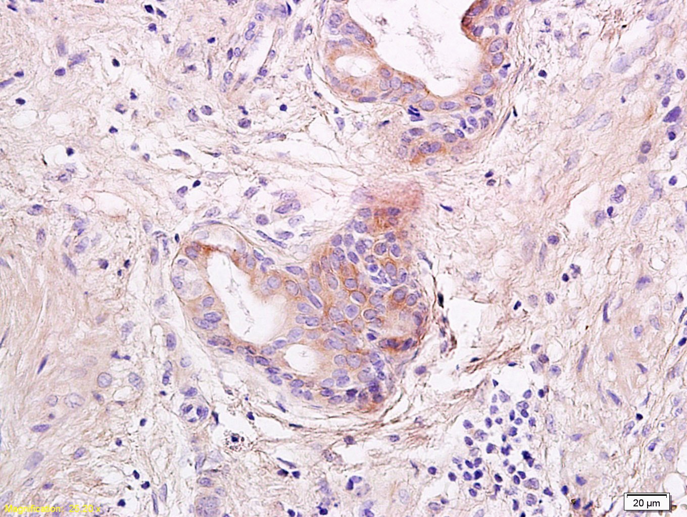 Anti-IL-23 Polyclonal Antibody
