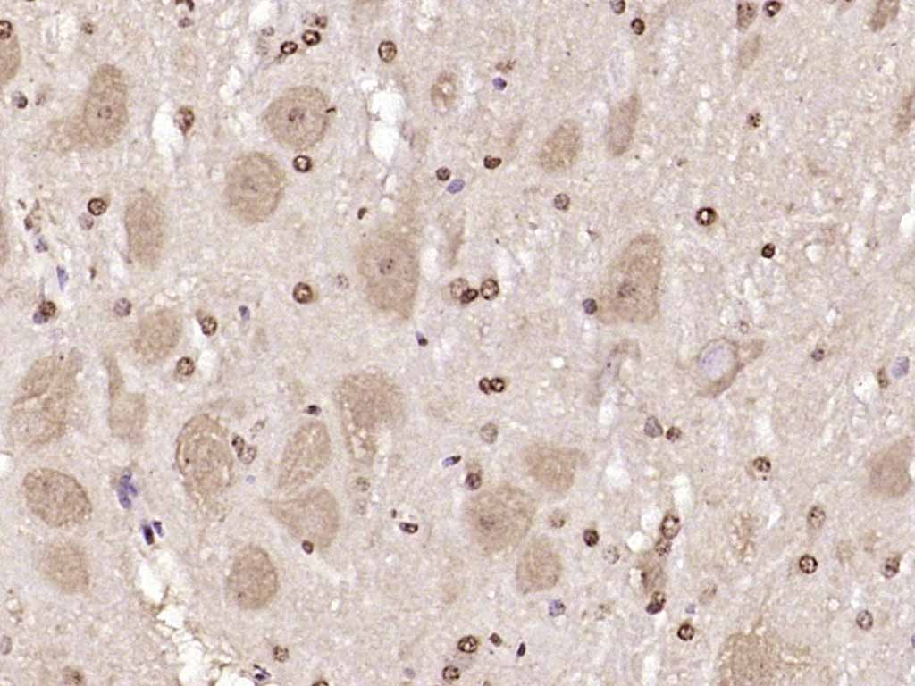 Anti-JNK1/2/3 Polyclonal Antibody