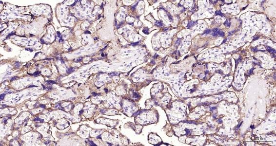 Anti-ITGAV Polyclonal Antibody