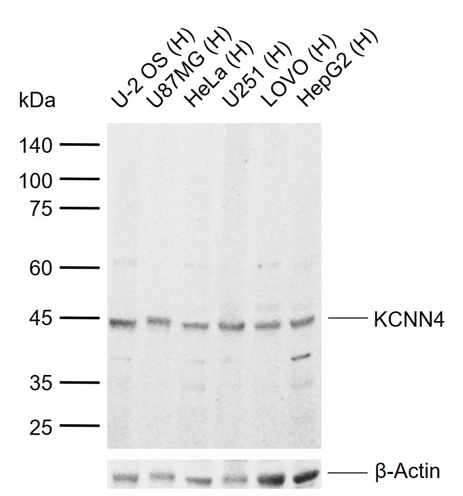 Anti-KCNN4 Polyclonal Antibody