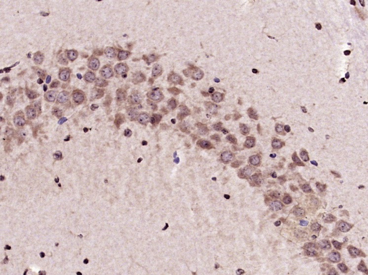 Anti-KEAP1 Polyclonal Antibody