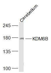 Anti-KDM6B Polyclonal Antibody