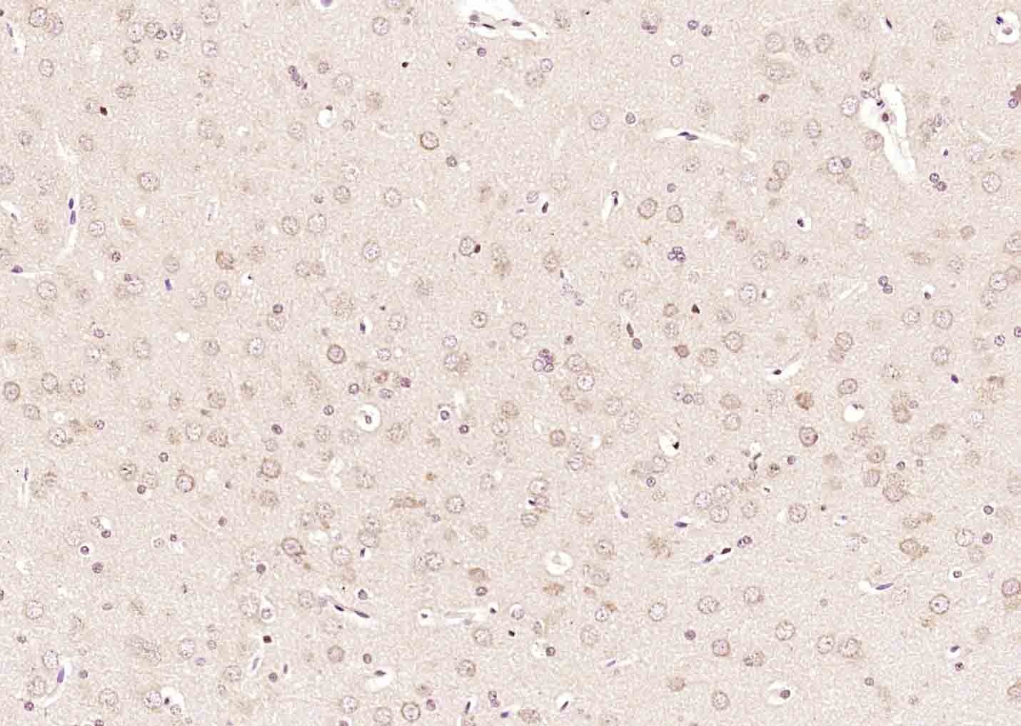 Anti-NR0B2 Polyclonal Antibody