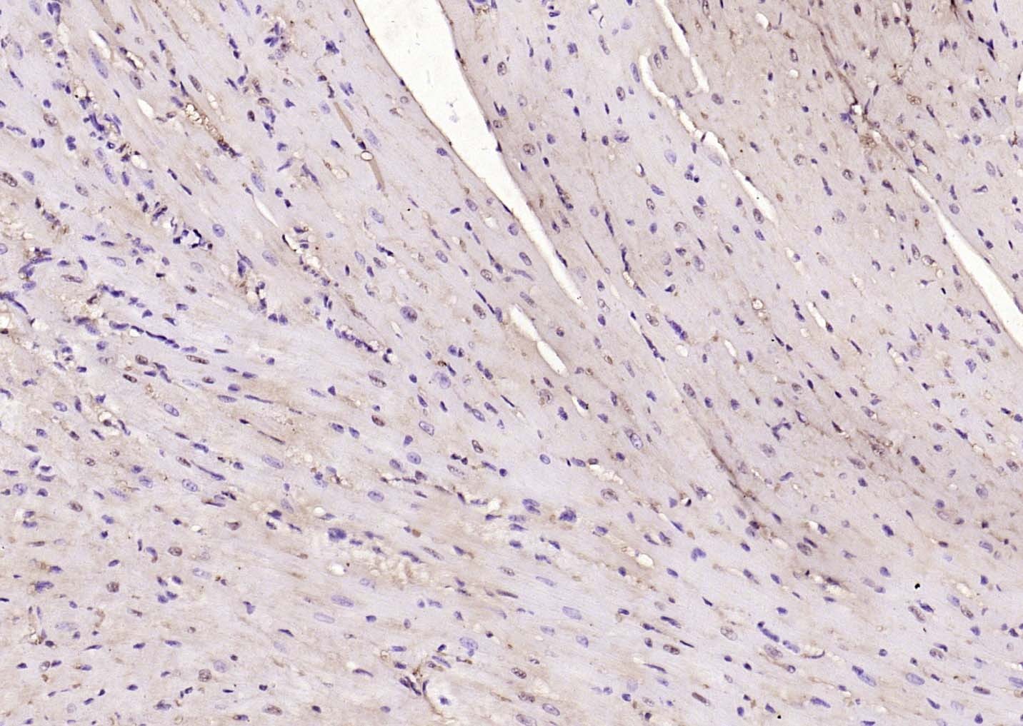 Anti-NOX4 Polyclonal Antibody