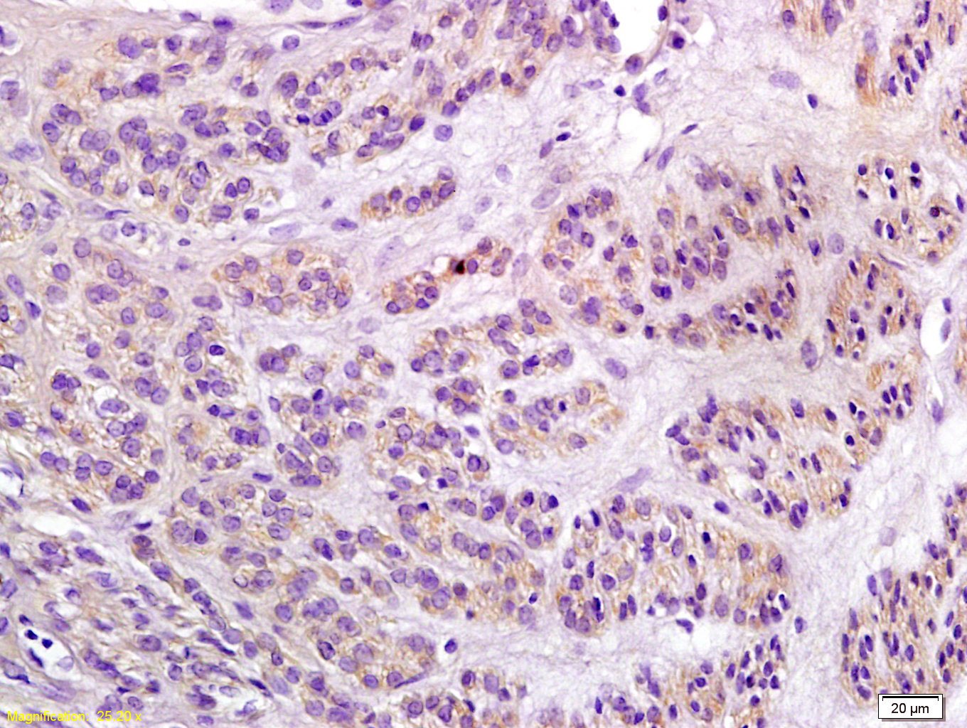 Anti-Notch 1 Polyclonal Antibody