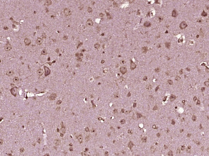 Anti-OPRM1 Polyclonal Antibody