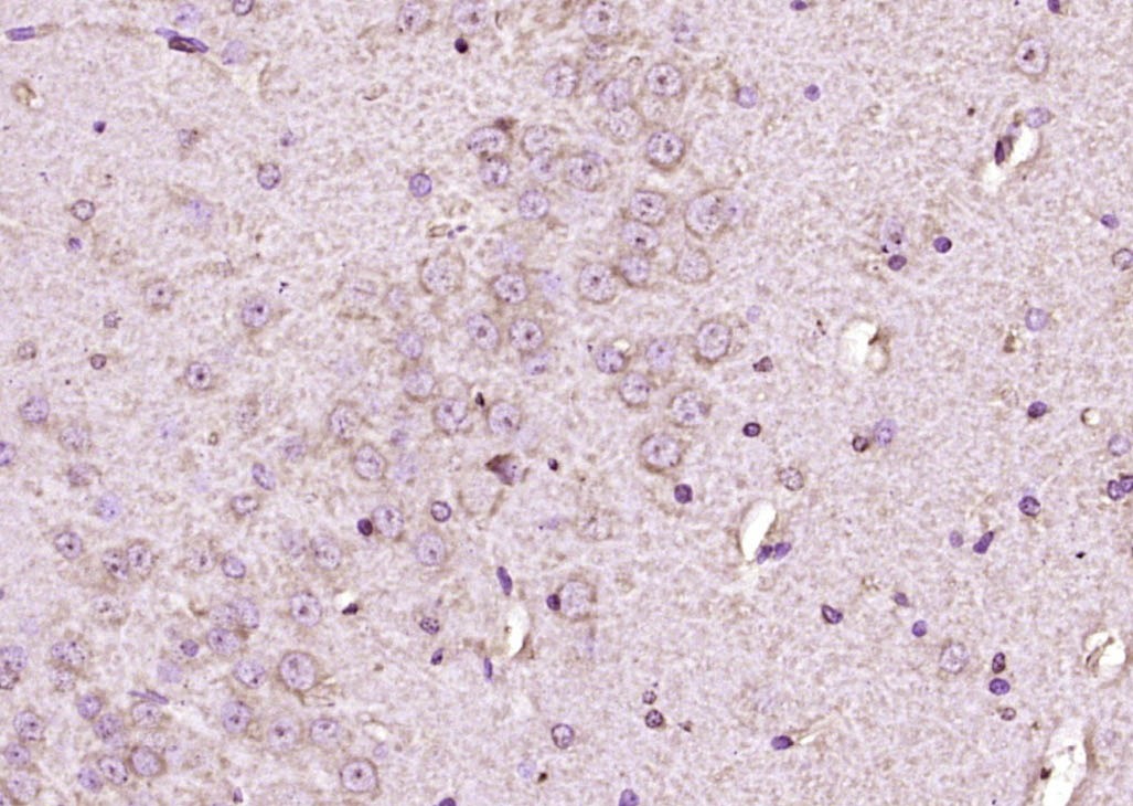 Anti-NAV1.7 Polyclonal Antibody